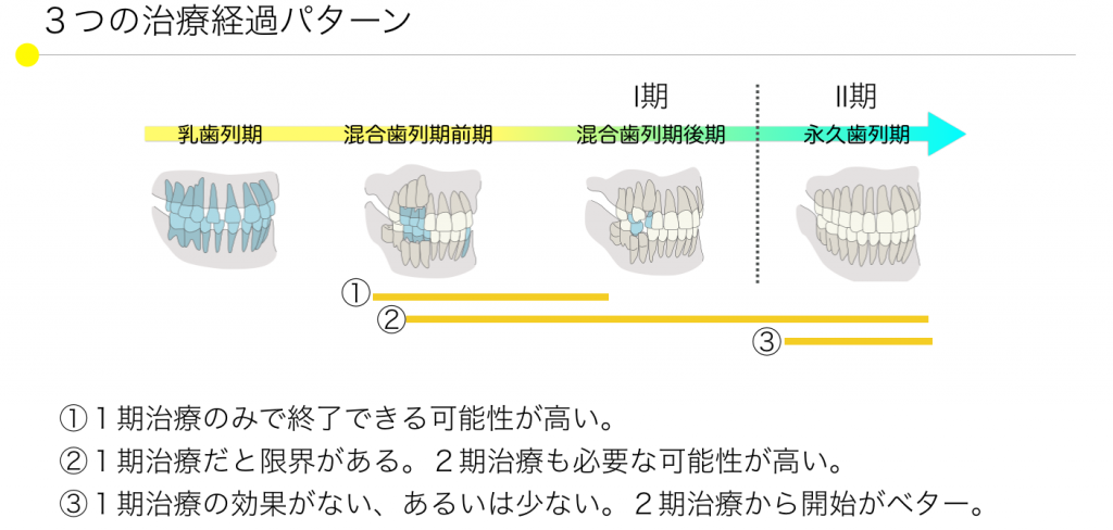 小児矯正をいつから始めるか