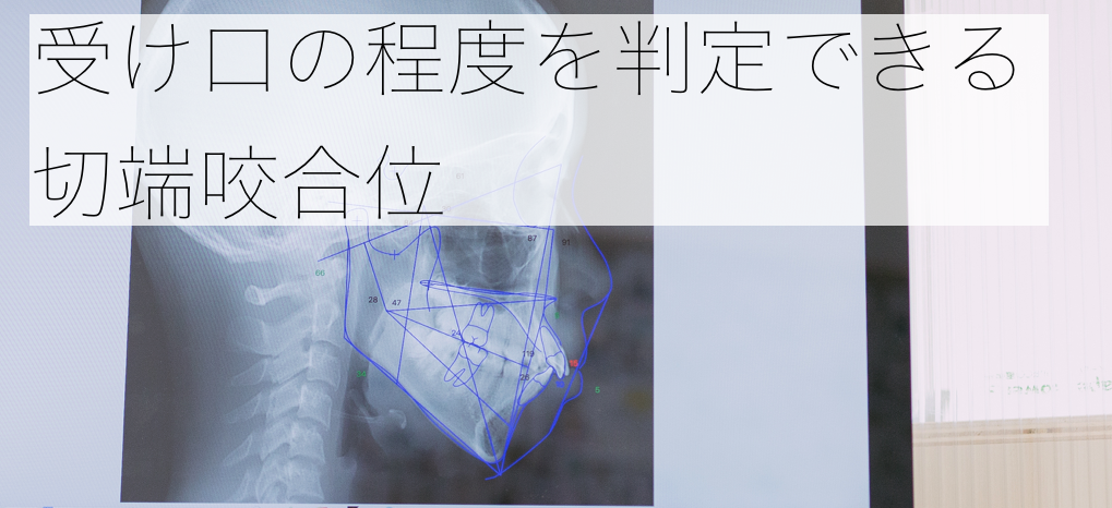 受け口の程度を判定