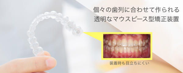 インビザラインアライナー