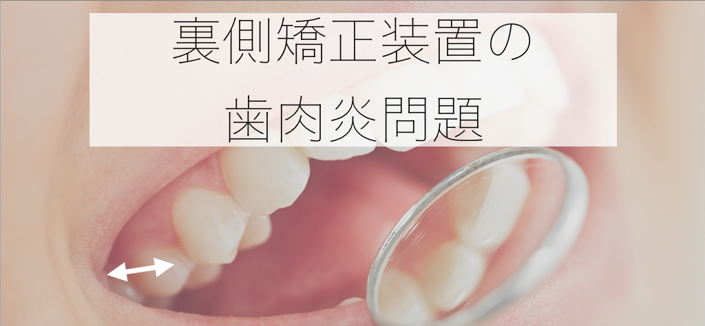 裏側装置・歯肉炎