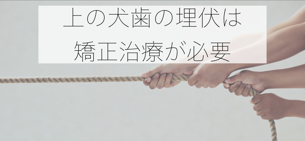 上顎犬歯 埋伏 開窓