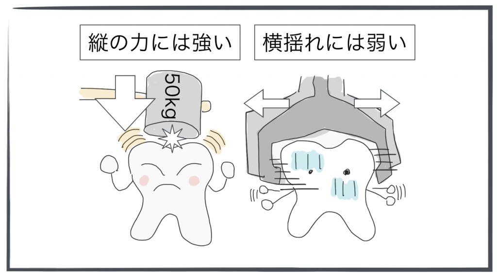奥歯は横よれに弱い