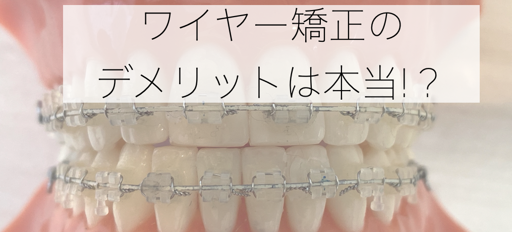 ワイヤー矯正のデメリット