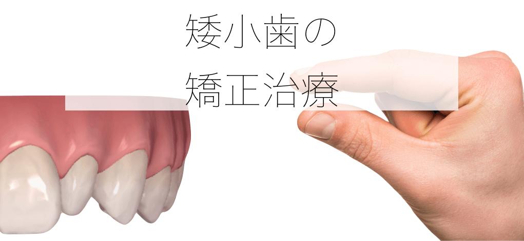 矮小歯の矯正治療