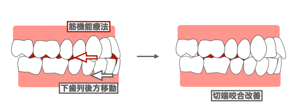 送料無料/新品】 【裁断済み】矯正臨床における咬合分類 098 健康/医学