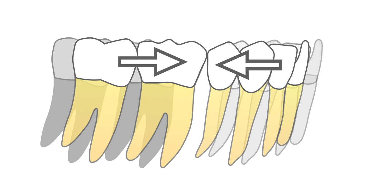 <下の第一大臼歯の歯根の移動量は大きい>
