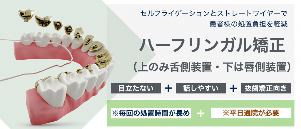 ハーフリンガル矯正・裏側矯正