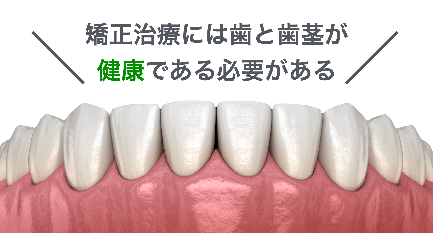 矯正治療には健康な歯と歯茎が必要