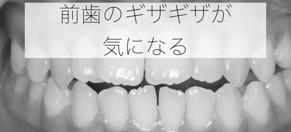 前歯のギザギザの治し方 – 千葉県八千代市の矯正歯科専門医院【まきの歯列矯正クリニック】