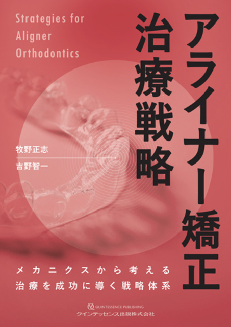 アライナー治療戦略