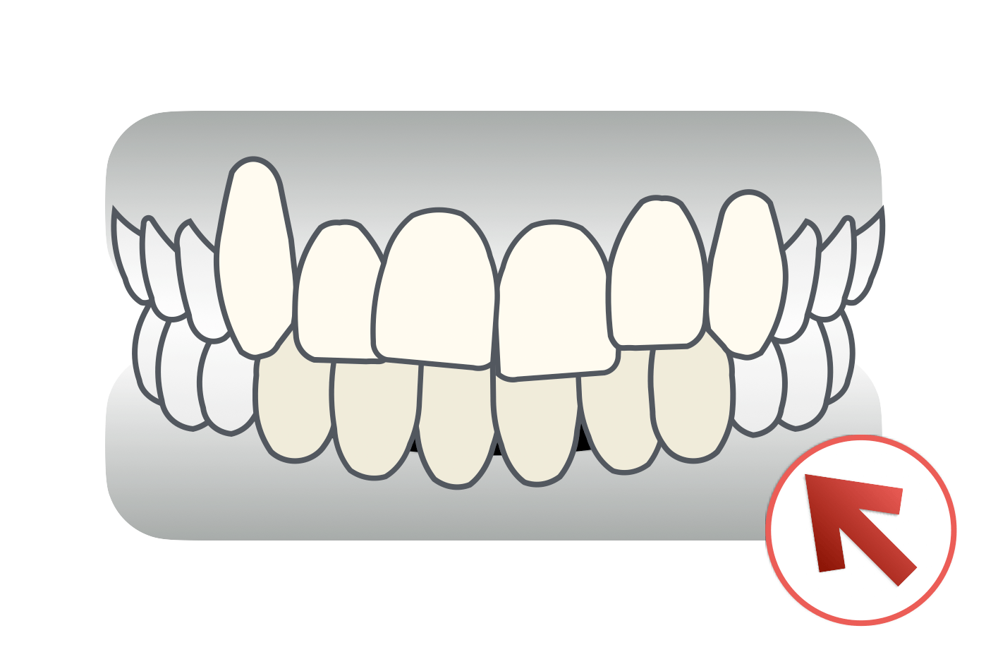 ミドルエイジ(40代・50代)の矯正治療例