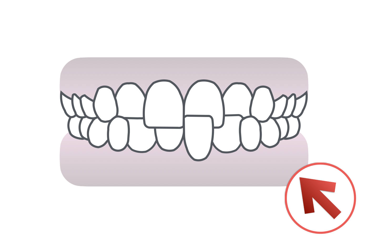 プレオルソ・小児矯正治療症例写真集