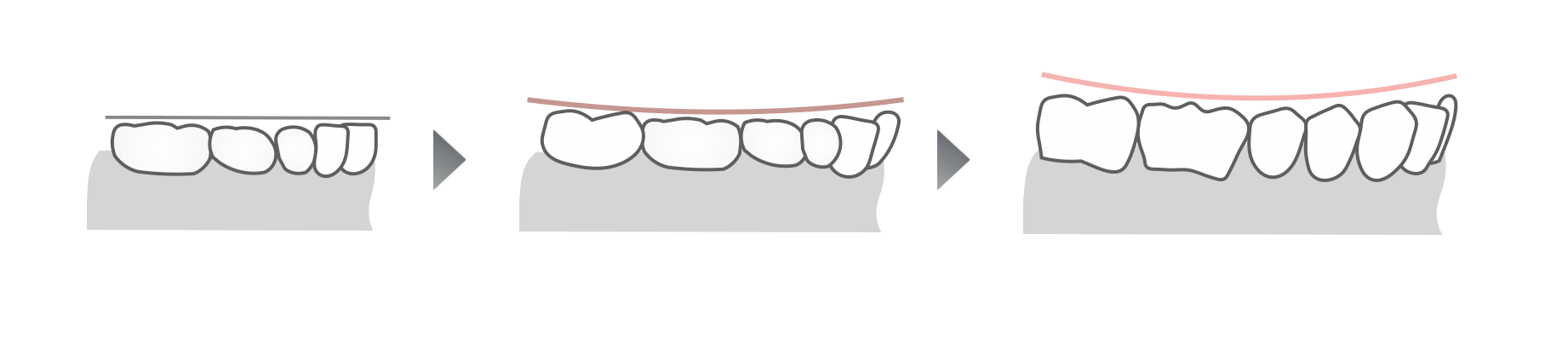 年齢とともにスピーカーブの変化