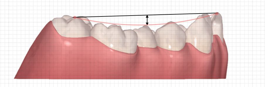 スピーカーブの測定方法