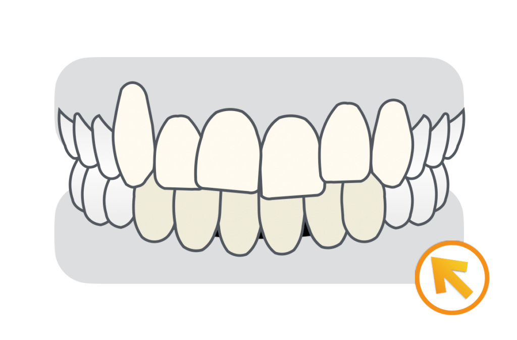 ミドルエイジ（40〜60代）治療例