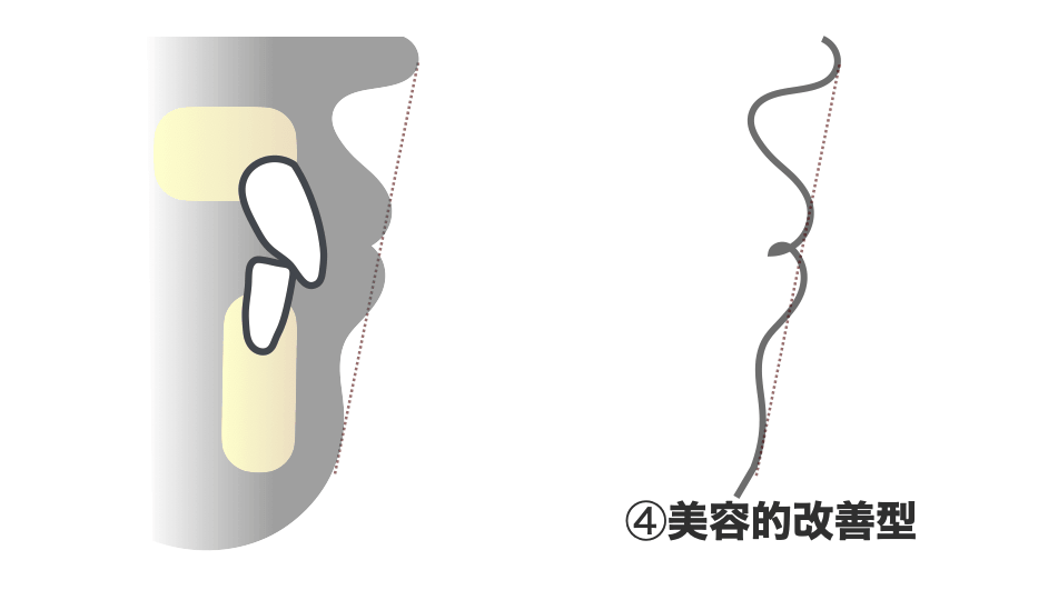 美容的改善型